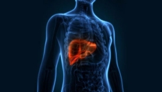 লিভারের সমস্যায় ত্বকে দেখা দেয় ৪ সতর্ক সংকেত