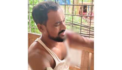 শ্রীনগরে জমি সংক্রান্ত বিরোধের জেরে প্রবাসী টেঁটাবিদ্ধ